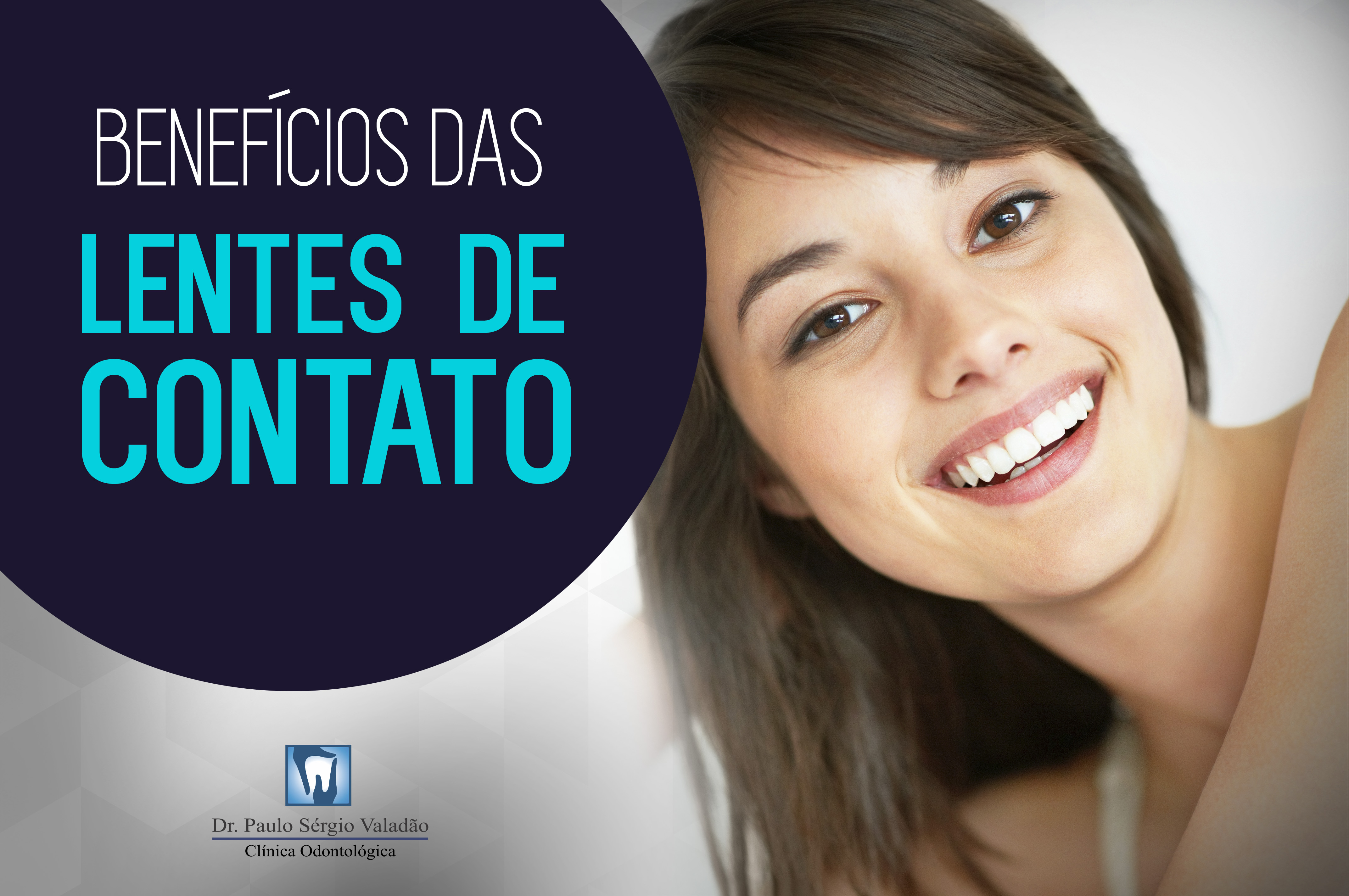 Benefícios e naturalidade das Lentes de Contato Dental