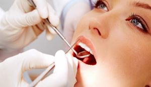 Profilaxia odontologica - odonto sergio