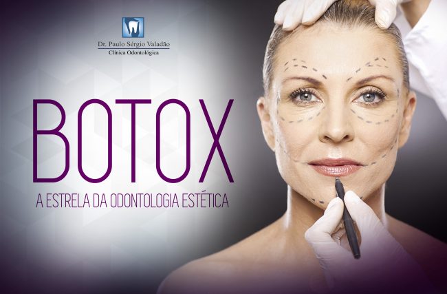 Botox: A estrela da Odontologia Estética